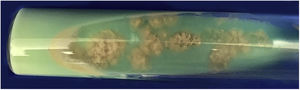 M. abscessus colonies grew in Lowenstein Jensen culture after 7 days
