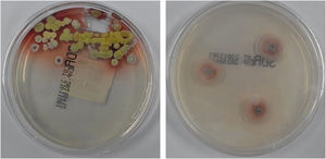 Colonies of Talaromyces marneffei were cultured from purulent secretions of skin lesions.