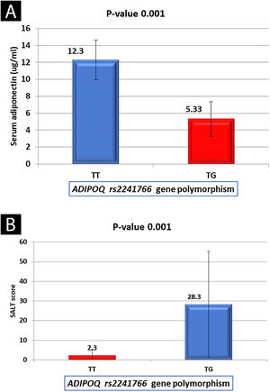 ADIPOQ (rs2241766) genotypes in relation to: (A) Serum adiponectin levels among the studied AA patients. (B) SALT score of studied AA patients.