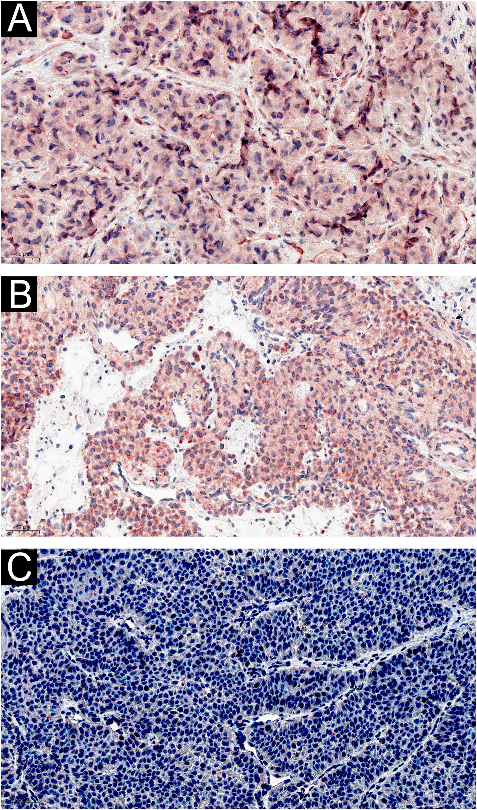 The clinicopathologic and immunohistochemical features of 60 cutaneous ...