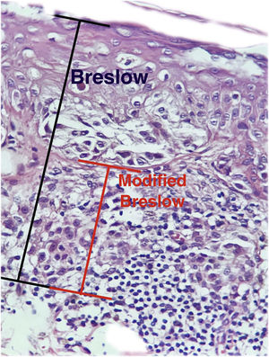 Breslow measurement (in black) compared to the modified Breslow (in red).