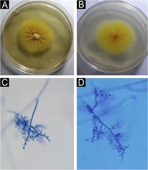 Trichophyton benhamiae. (A) Macromorphology of the colony showing a yellowish-beige, velvety surface with radial growth. (B) Back of the colony, bright yellow; (C and D) micromorphology, with septate, branched hyaline hyphae and rounded, pyriform microconidia, grouped in clusters or arranged laterally and at the ends of the hyphae. Lactophenol-cotton blue (×100 and ×400).