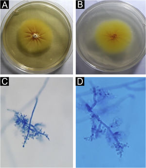 Trichophyton benhamiae. (A) Macromorphology of the colony showing a yellowish-beige, velvety surface with radial growth. (B) Back of the colony, bright yellow; (C and D) micromorphology, with septate, branched hyaline hyphae and rounded, pyriform microconidia, grouped in clusters or arranged laterally and at the ends of the hyphae. Lactophenol-cotton blue (×100 and ×400).
