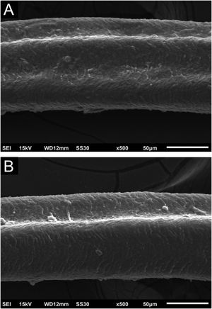 Scanning electron microscopy – (A) Eyelash with two channels (×500); (B) Eyelash with clearly visible single channel (×500).