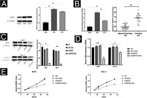 SIRT6 knockdown inhibited CSCC cell proliferation. (A) Western blot analysis of SIRT6 protein expression in A431, SCL-1, and HaCaT cells. (B) qRT-PCR analysis of SIRT6 mRNA expression in A431, SCL-1, and HaCaT cells, as well as in 20-cases of CSCC and adjacent normal tissues. (C‒D) Validation of SIRT6 protein and mRNA knockdown effects in A431 and SCL-1 cells. (E) CCK-8 assay of CSCC cell proliferation, measuring absorbance at 450 nm at 12 h, 24 h, 48 h, and 72 h; *p < 0.05, **p < 0.01.