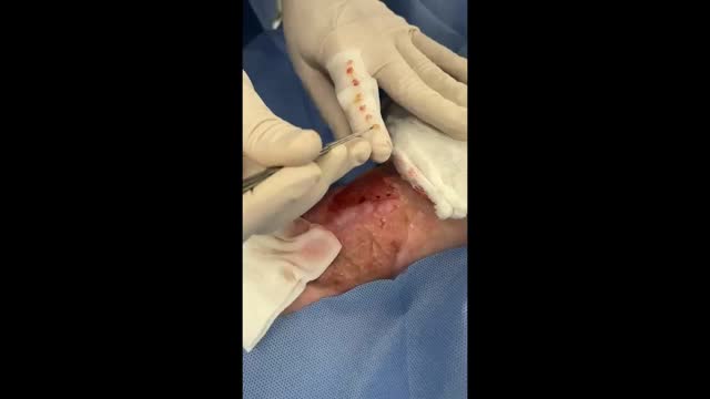 https://ars.els-cdn.com/content/image/1-s2.0-S0365059624000333-mmc5.mp4
