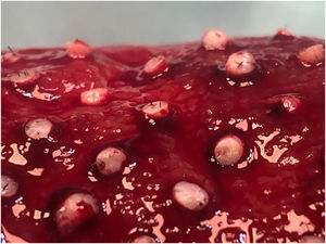 Close-up view of grafts implanted in the ulcer bed on the leg.