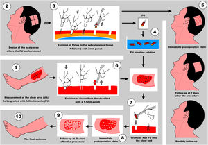 Practical illustration of the follicular units (FU) graft sequence.