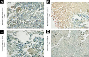 Immunohistochemical analysis of ATF4 and TFCHOP expression. Tissues obtained from tumor material from the control (A and C) and 4 IU/kg (B and D) groups were evaluated based on the immunohistochemical expression of these proteins. The photographs were obtained using an Axiolab 5 microscope (Zeiss) and analyzed using the ImageJ FIJI software program. The control and 4 IU/kg groups were chosen to represent dose extremes.