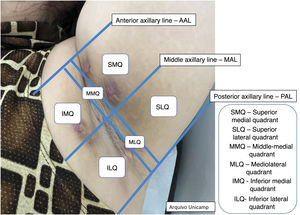 Axillary and intermammary region.