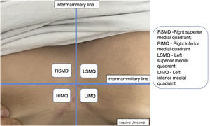 Intermammary region.