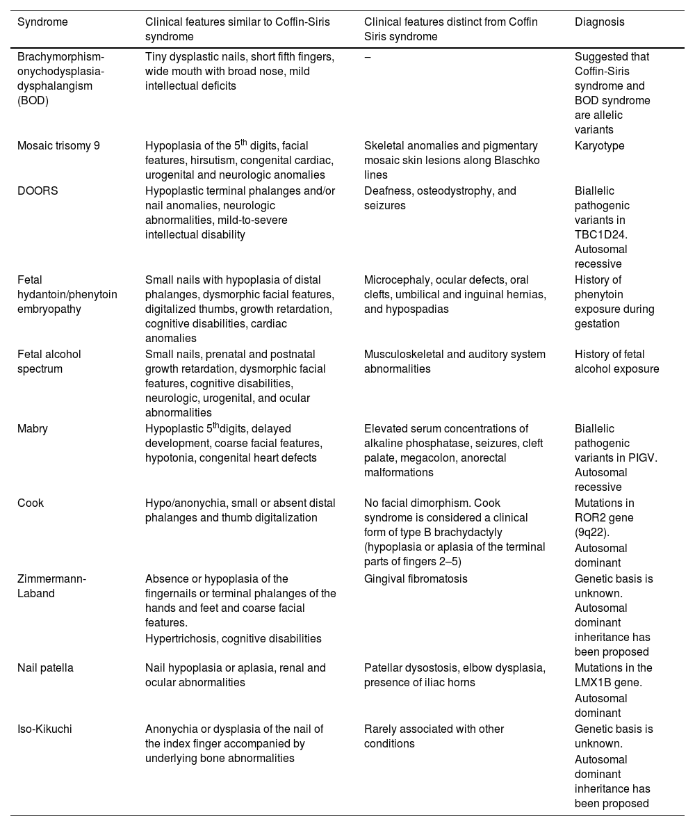 Tables