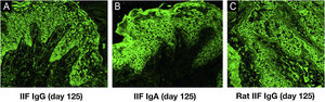 Indirect Immunofluorescence (IIF) results of this patient serum. IIF using normal human skin showed negative IgG staining (A) and positive intercellular staining of IgA (B). (C) IIF using rat bladder tissue showed IgG staining on granular cell surface and BMZ.