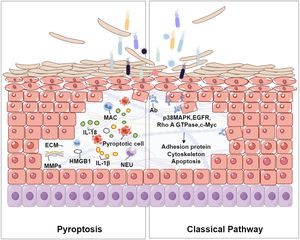 The relationship between pyroptosis and acantholysis within the epidermis. Pyroptotic cells, characterized by the formation of Gasdermin-mediated pores, release pro-inflammatory cytokines such as IL-1β and IL-18. These cytokines attract Neutrophils (NEU) and Macrophages (MAC), intensifying the inflammatory environment. The resultant oxidative stress and production of Matrix Metalloproteinases (MMPs) may degrade the Extracellular Matrix (ECM), weakening the structural integrity of the epidermis and leading to the detachment of keratinocytes, a process known as acantholysis. This figure illustrates the complex interplay between cellular death, inflammation, and tissue disruption in the pathogenesis of blistering skin disorders. The right part of the figure shows the classical pathway of acantholysis in pemphigus. Bacterial interaction triggers antibody production, activating signaling molecules (p38 MAPK, EGFR, Rho A GTPase, c-Myc), which affect the cytoskeleton and adhesion proteins, leading to cell detachment and apoptosis.