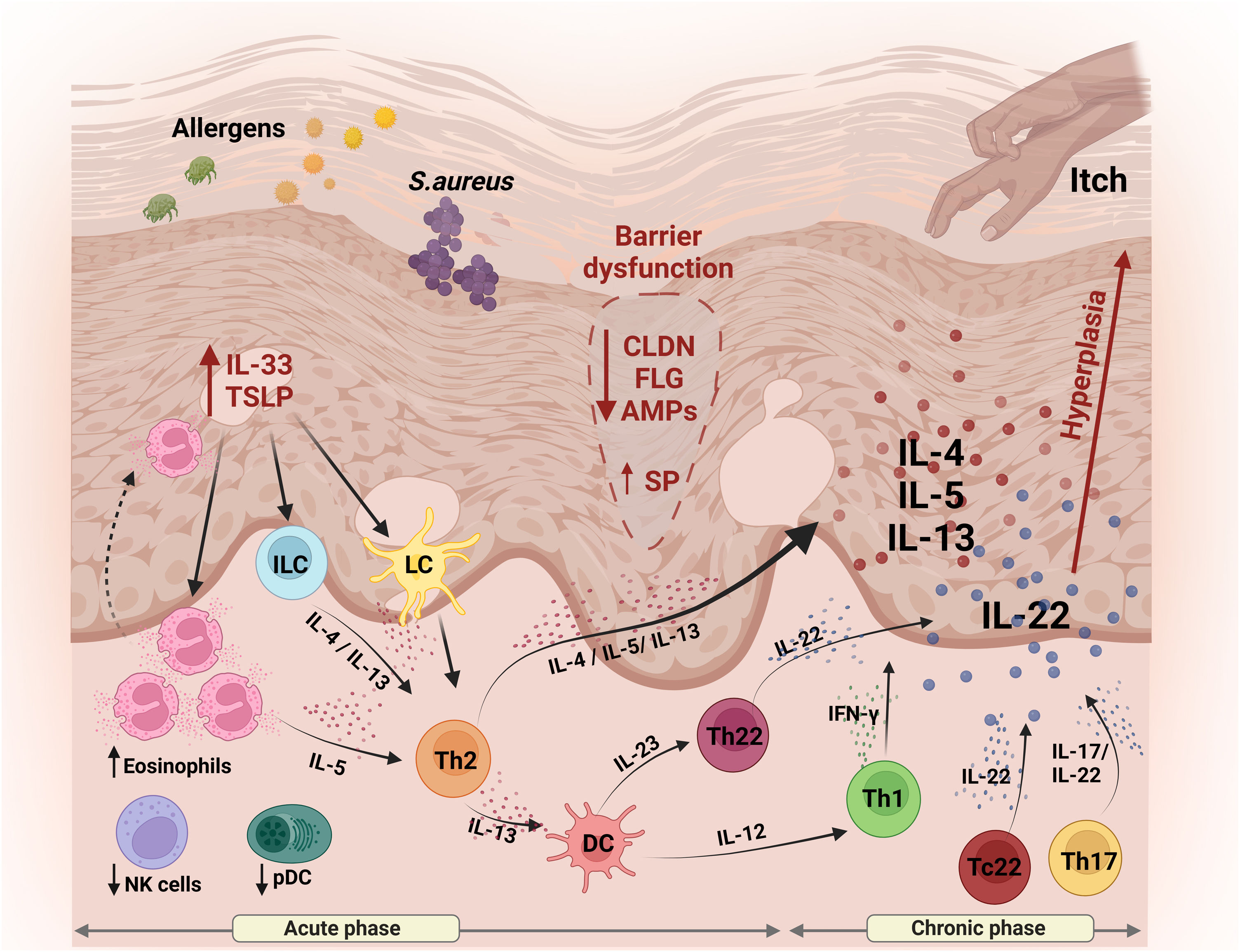 Skin Inflammatory Process Inflammasome pathways in atopic dermatitis: insights into inflammatory ...