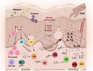 Schematic representation of skin barrier (SC) alterations and the main aspects of innate and adaptive immunity involved in the pathogenesis of AD. Reduced expression of skin proteins (FLG and CLDNs) results in disruption of the BC and transepidermal water loss, facilitating the entry of external pathogens. Keratinocytes release TSLP and IL-33, amplifying the inflammatory response, attracting and activating Langerhans cells, ILCs and the recruitment of eosinophils. Together, these cells contribute to the release of Th2-type cytokines, including IL-4, IL-5 and IL-13. Dendritic cells, in turn, release IL-12 and IL-23, promoting activation of both the Th1 and Th22 profiles, resulting in the secretion of IFN-γ and IL-22, respectively. Pro-inflammatory cytokines IL-5, IL-13 and IL-31 are released by keratinocytes, which play a role in modulating pruritus, contributing to the perpetuation of the inflammatory process. In addition, IL-22 stimulates keratinocyte proliferation, promoting epidermal hyperplasia. IL, Interleukin; TSLP, thymic stromal lymphopoietin; CLDN, claudin; FLG, filaggrin; AMPs, antimicrobial peptides; SP, serine protease; ILC, innate lymphoid cells; LC, Langerhans cells; DC, dendritic cells; NK, natural killer; pDC, plasmacytoid dendritic cells; Th, T-helper. Figure generated with BioRender.