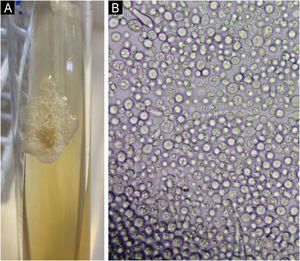 (A) Colony with creamy aspect. (B) Optical microscopy – predominance of blastoconidia with some hyphae.