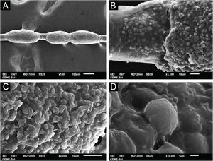 SEM of white piedra ‒ (A) Low magnification identifying nodules in the hair (×130). (B) Detail of the nodule, with initial lesion on the left (×1,100). (C) High magnification demonstrating clusters of blastoconidia (×2,200). (D) High magnification with detail of blastoconidia on the surface (×10,000).