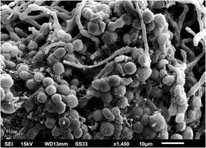 SEM of the C. debeurmannianum colony with a predominance of blastoconidia and some hyphae (×1.400).
