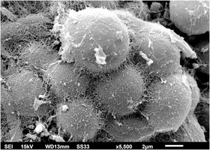 SEM of the C. debeurmannianum colony – detail of the blastoconidia adhered by reticular extracellular matrix, forming clusters resembling acini (×5.500).