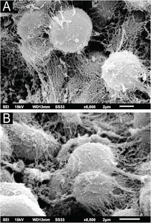 SEM of C. debeurmannianum colony ‒ (A) High magnification of blastoconidia covered by extracellular matrix (×6,000). (B) Detail of covered blastoconidia, adhered to each other (×8.500).