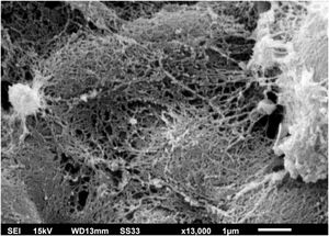 SEM of C. debeurmannianum colony – detail of dense extracellular matrix covering the blastoconidia (×13.000).