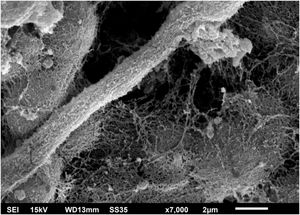 SEM of the C. debeurmannianum colony – detail of the extracellular matrix formation also by hyphae (×7.000).