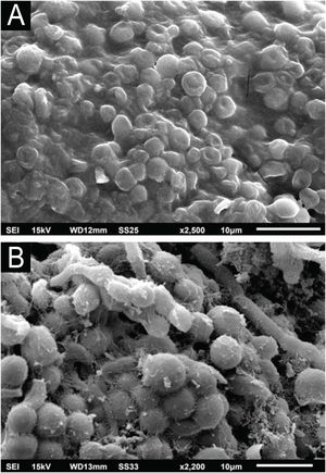 SEM – comparative demonstration of the similarity between the appearance of the white piedra nodule (A; ×2,500) and the C. debeurmannianum colony (B; ×2.200).