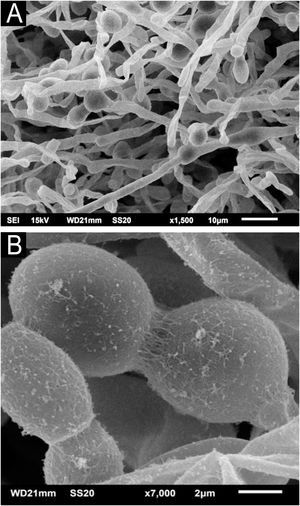 SEM of T. mucoides colony – (A) Fungal filaments and blastoconidia not adhered by extracellular matrix (×1,500). (B) Detail of blastoconidia with discrete extracellular matrix production (×7.000).