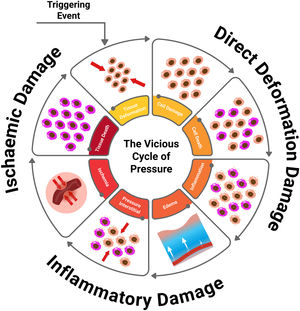 Vicious cycle of PI: direct deformation damage (cellular damage, cell death, and inflammation), inflammatory damage (edema, increased interstitial pressure), ischemic damage (ischemia, tissue death), leading to cellular deformation.