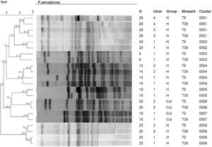 Dendrogram of genetic similarity of ulcers with P. aeruginosa. There was no change in the identity of P. aeruginosa in any ulcer in both groups.