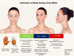 Division of the face into 5 cosmetic units for segmented and spaced application of the phenol-croton peel, ensuring procedure safety. Each unit represents 0.5%–1.5% of the Body Surface Area (BSA). The entire face plus the anterior neck represents 5% of the BSA. The perioral region with cheek feathering represents 1% of the BSA, and the periocular region (“Zorro Mask”) represents 1.5% of the BSA. In procedures with BSA greater than 1.5%, the patient must be monitored multiparametrically, safety breaks must be strictly enforced, and intravenous hydration must be instituted. Photos: Valua Vitaly. Editing and illustration: Ednei Ramos.