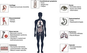 Clinical manifestations of VEXAS syndrome. Source: The authors, 2025. Created with Microsoft Designer 2025.