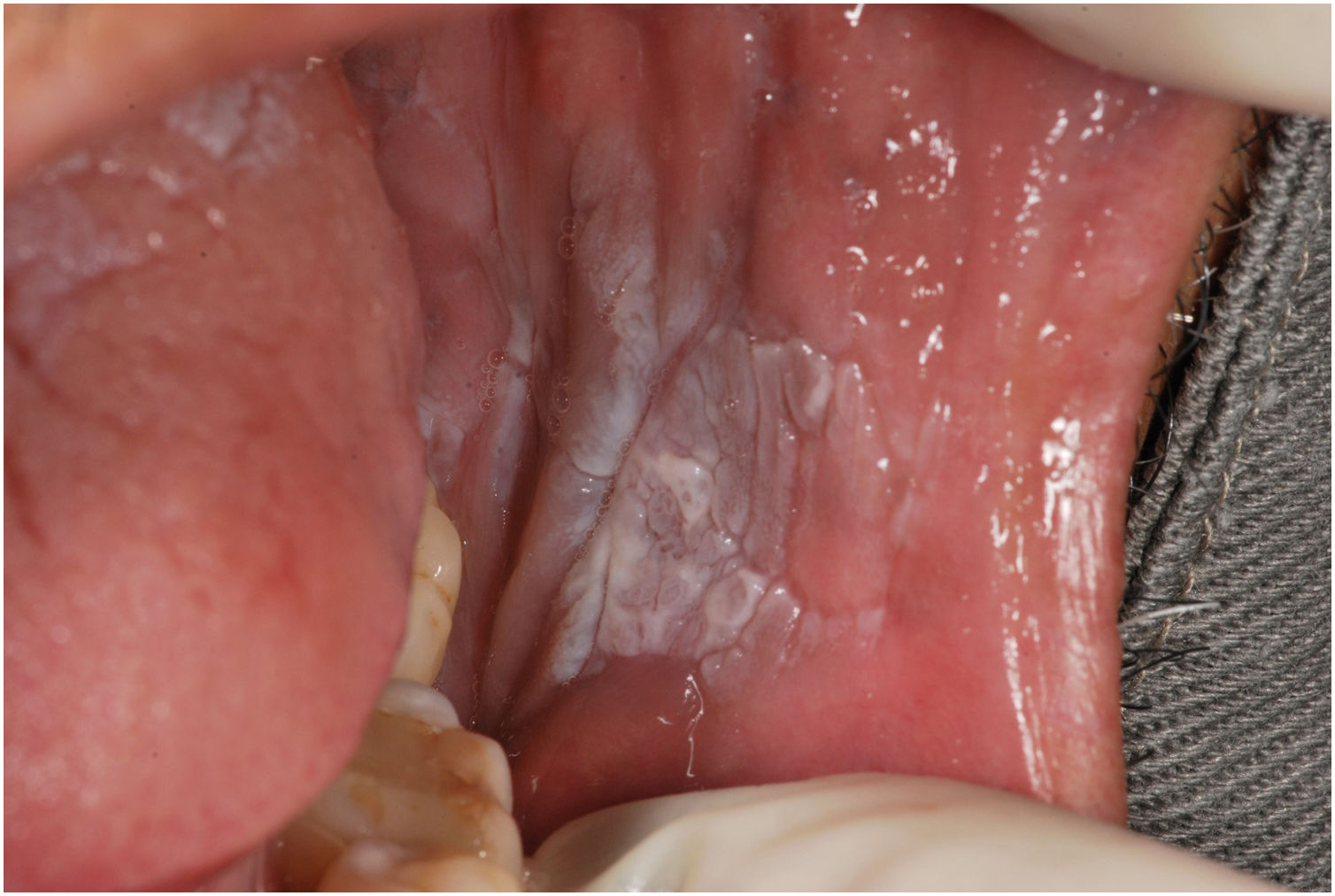 fig0005
