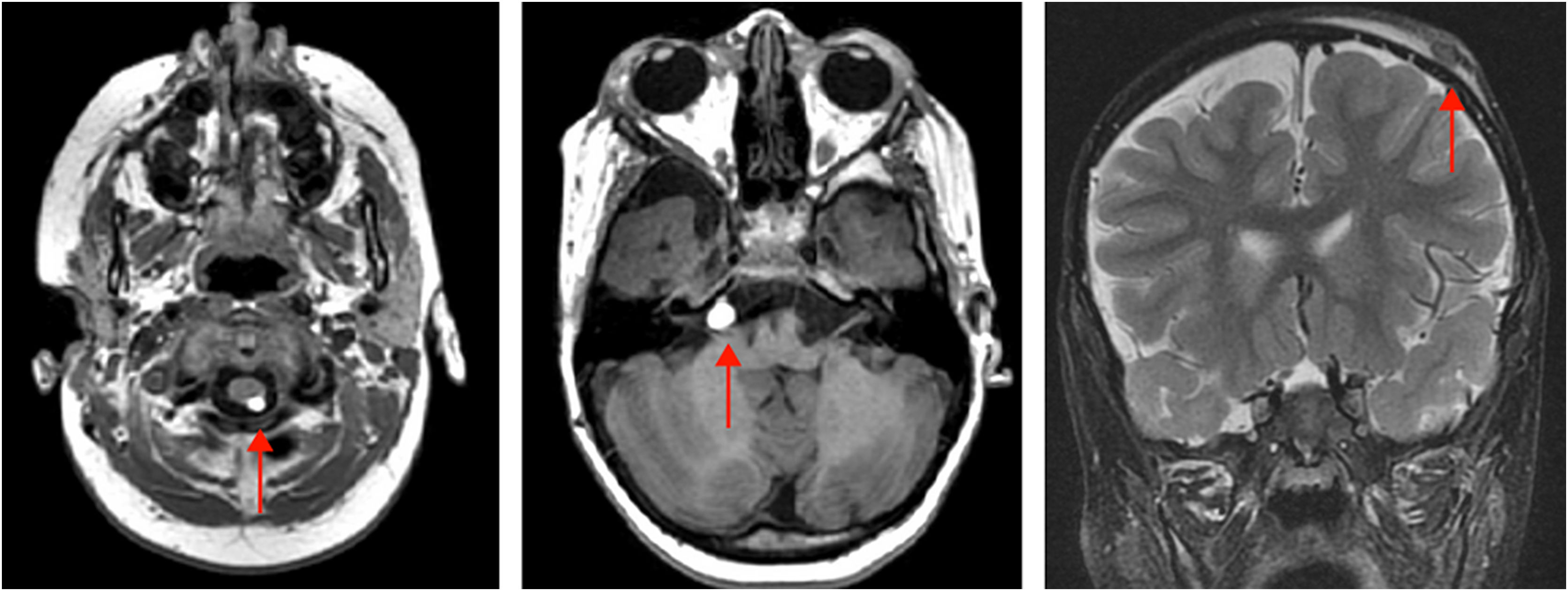 fig0015