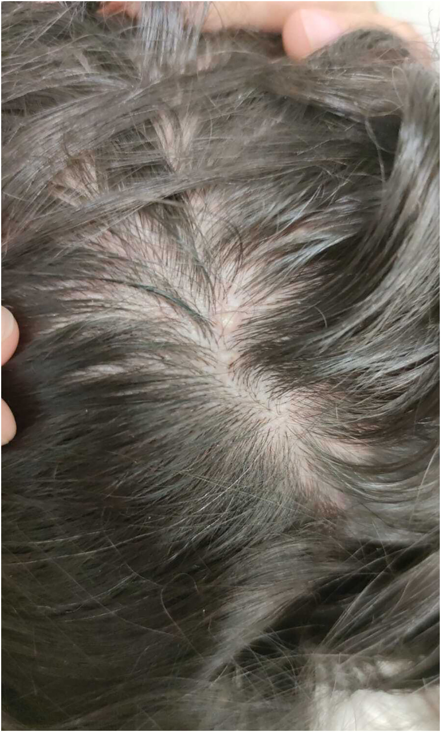 fig0010