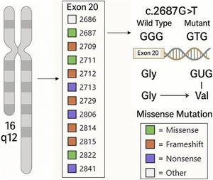 Schematic of CYLD exon 20 showing the novel NM_015247.2:c.2687 G > G>T (p.Gly896Val) missense mutation identified in our patient (GGG → GTG; Gly → Val). Previously reported MTE-associated mutations at this exon are also displayed.4,6 Mutation types are color-coded: Green, Missense; Orange, Frameshift; Purple, Nonsense; Grey, Other (Large deletions and rearrangements). Gly, Glycine, Val, Valine, MTE, Multiple Trichoepithelioma.