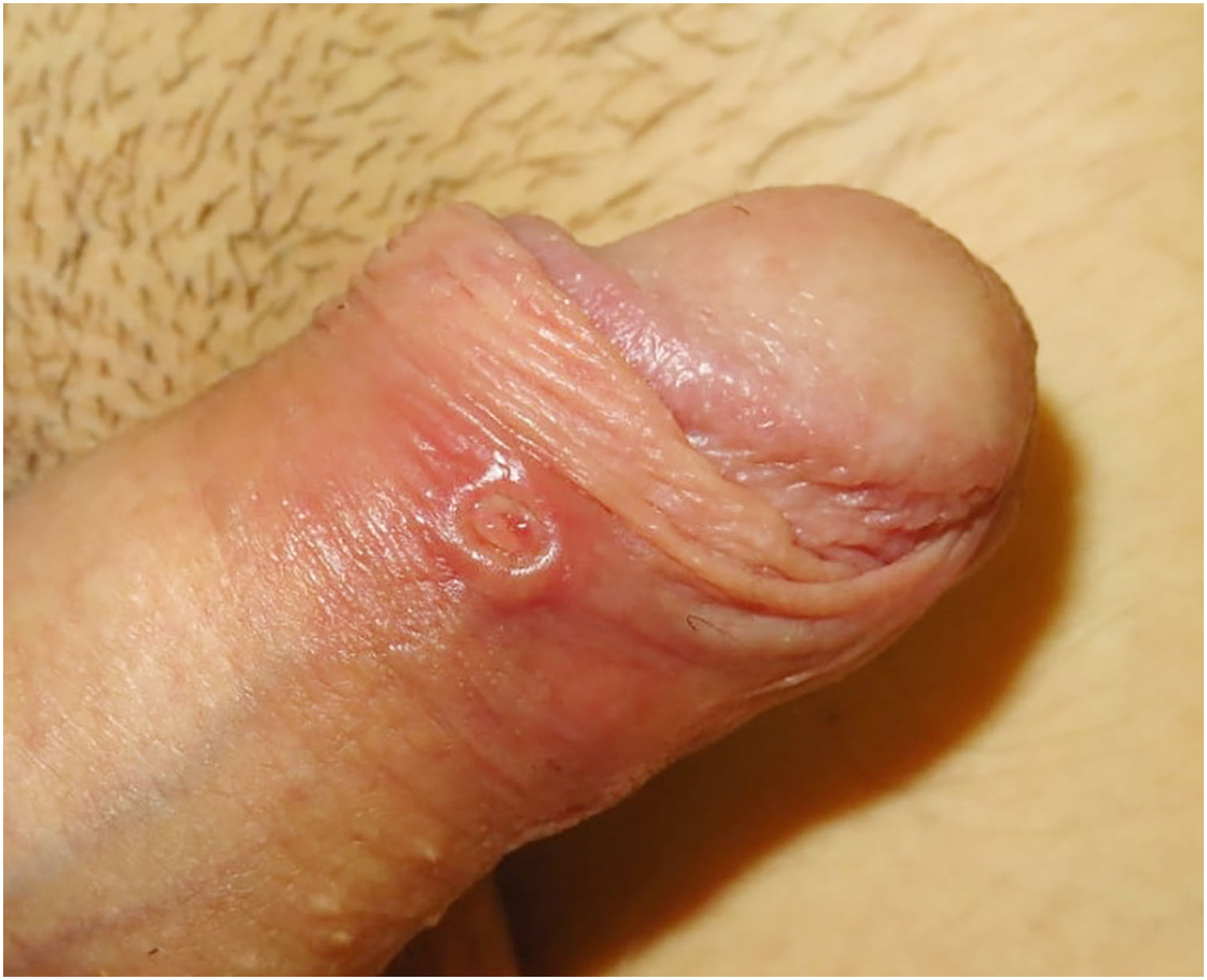 fig0005