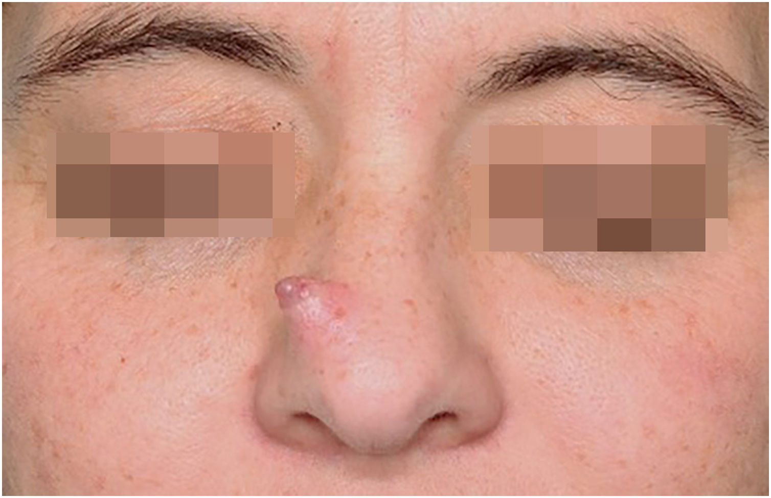 fig0005