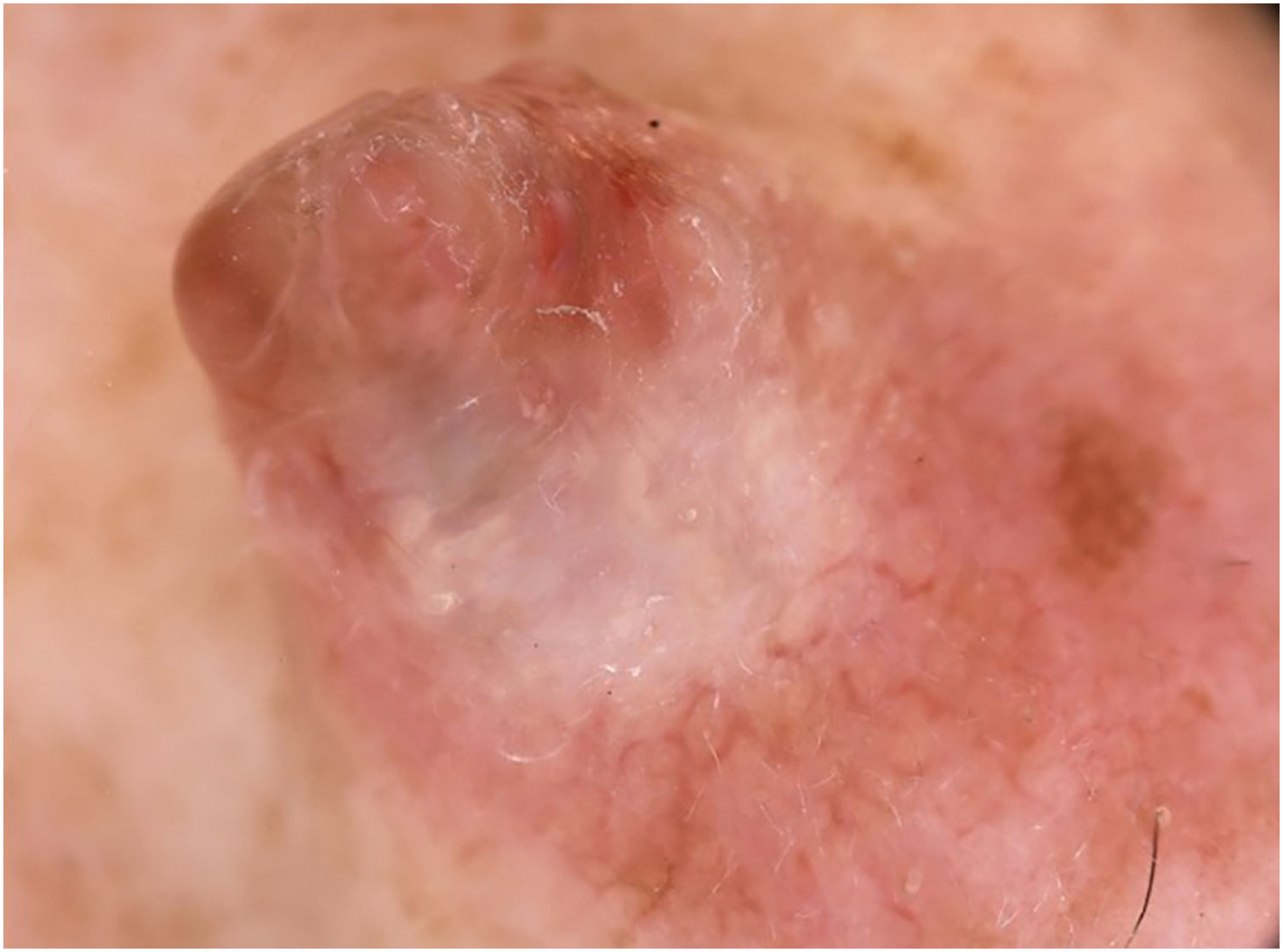 fig0010