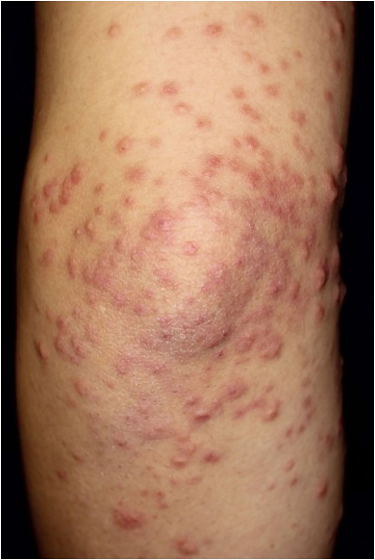 fig0010