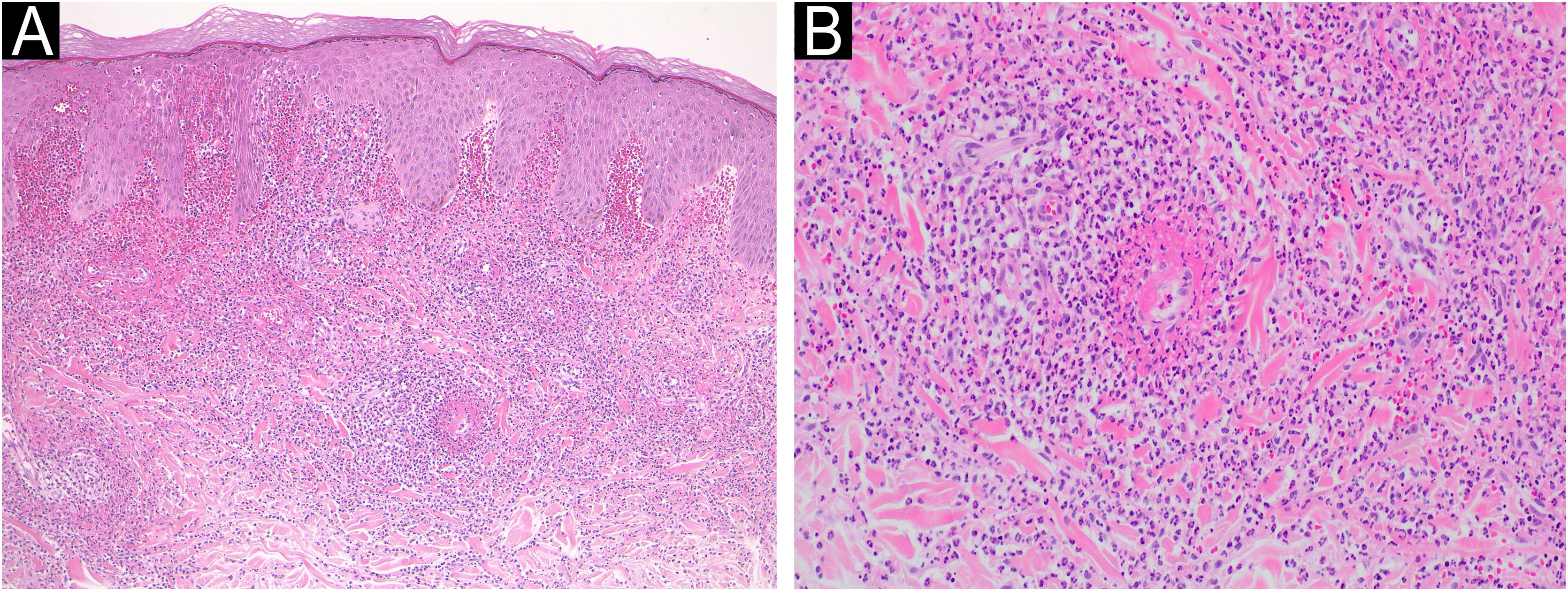 fig0015