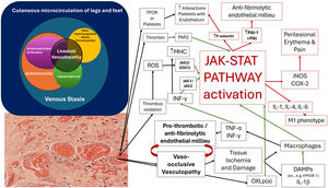 Proposed mechanisms of JAK/STAT pathway involvement in the pathogenesis of livedoid vasculopathy, promoting a prothrombotic and antifibrinolytic environment in the cutaneous environment. COX2, Cyclooxygenase 2; DAMPs, Damage-Associated Molecular Patterns; HMGB1, High-Mobility Group B Protein 1; iNOS, Inducible Nitric Oxide Synthase; IL, Interleukin; IL-1β, Interleukin 1 beta; JAK-STAT, Janus Kinase-Signal Transducer and Transcription Activator; PAI 1, Plasminogen Activator Inhibitor type 1; MHC, Major Histocompatibility Complex; PAR2, Protease-Activated Receptor type 2; ROS, Reactive Oxygen Species; tPA, Tissue Plasminogen Activator; TNF-α, Tumor Necrosis Factor alpha; TPO-R, Thrombopoietin Receptor.