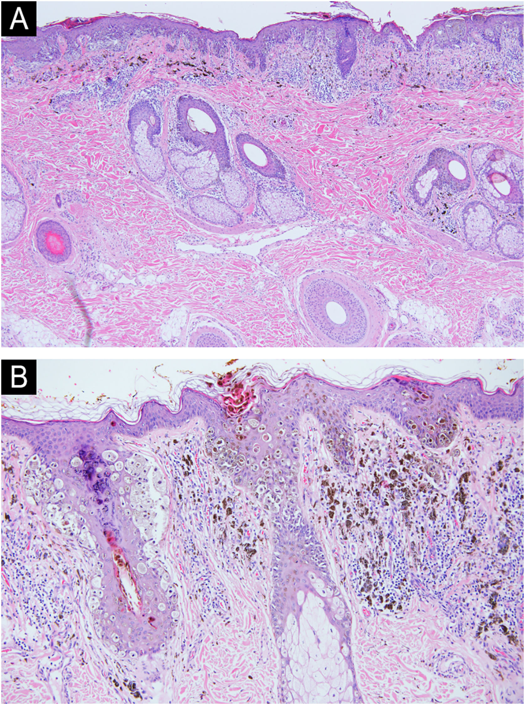 fig0010