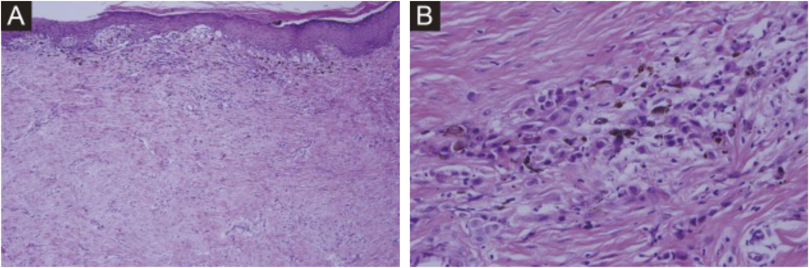 fig0010
