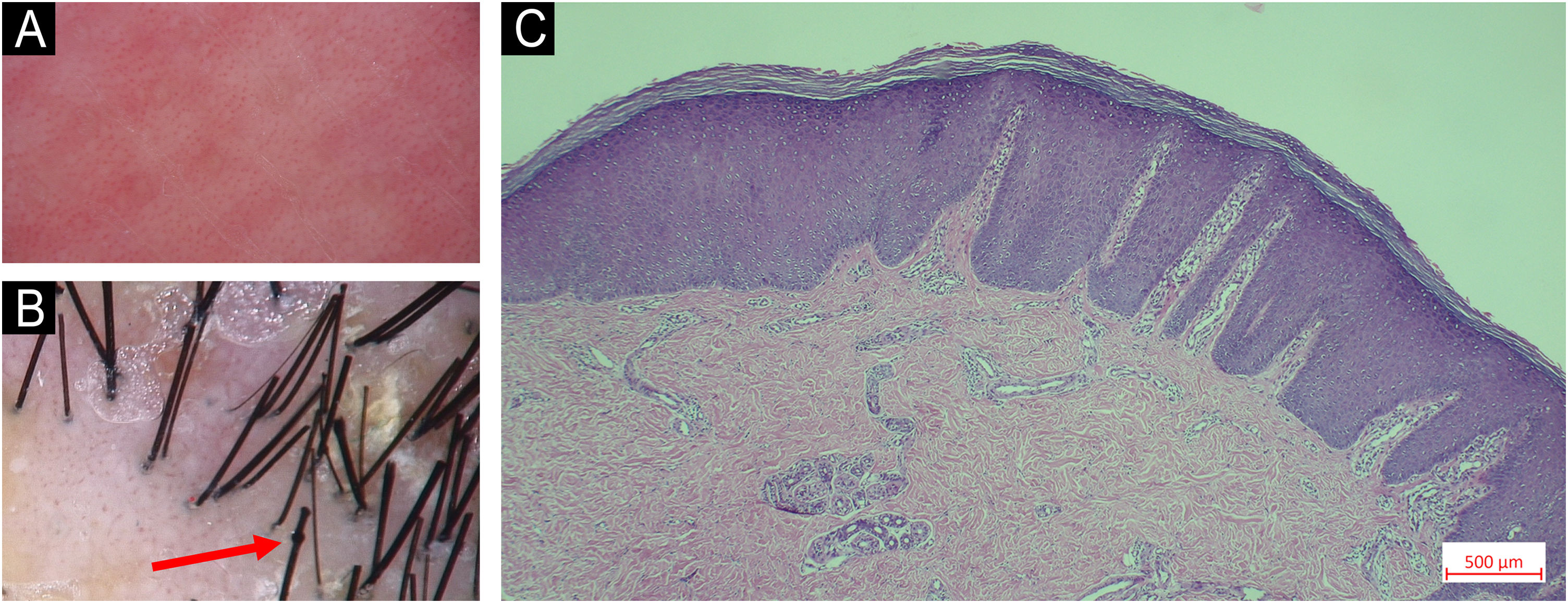fig0010