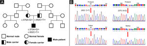 Genetic findings. (A) Family pedigree illustrating the co-segregation of SPINK5 variants. (B) Sanger sequencing of the proband showing compound heterozygosity for c.652C>T (p.Arg218*) and c.575A>G (p.Asn192Ser); each parent heterozygous for one variant.