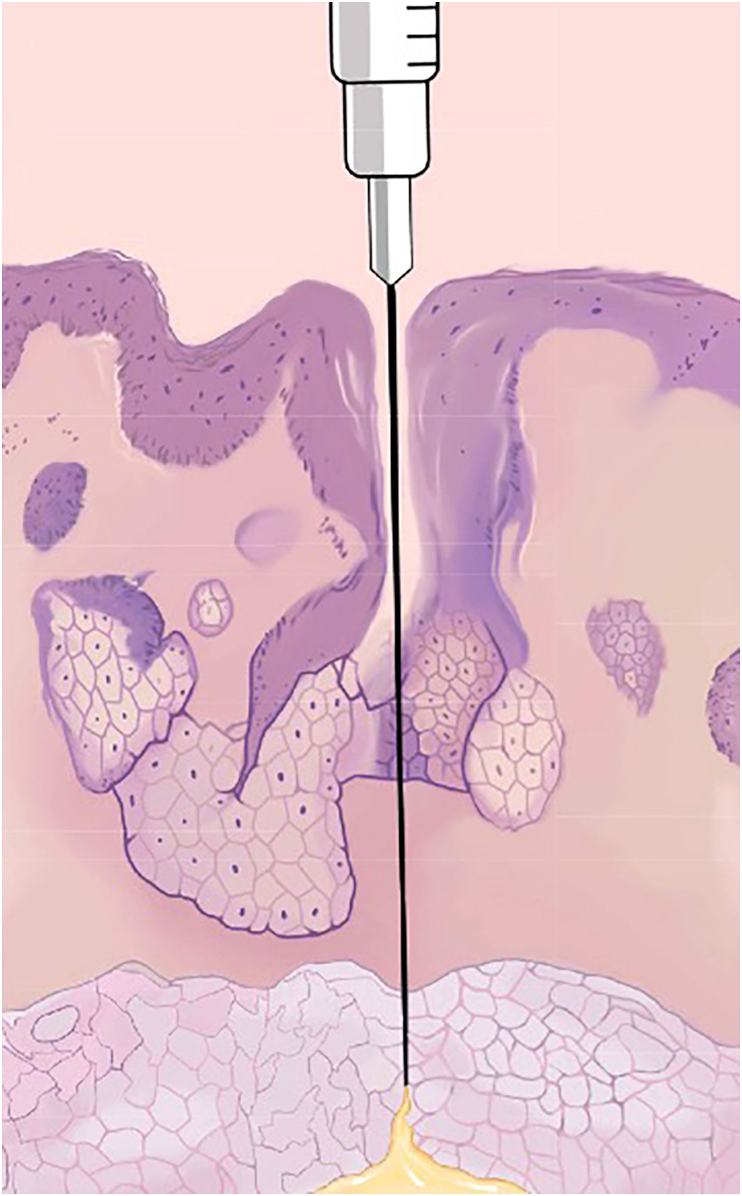 fig0005
