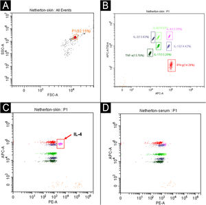 Cytokine profiling reveals tissue-specific elevation of IL-4 in skin lesions of the patient. (A‒B) Schematic of the gating strategy for cytokine bead array analysis. (A) The target bead Population (P1) was gated based on Forward and Side Scatter (FSC-A/SSC-A). (B) Within the P1 population, seven distinct bead subsets were distinguished by APC-A and APC-A750-A signals, each corresponding to a specific cytokine for detection (IL-2, IL-4, IL-6, IL-10, IL-17, TNF-α, and IFN-γ); quantification of each cytokine was ultimately performed via the PE fluorescence channel. (C) Selective elevation of IL-4 in lesional skin (71.33 pg/mg, indicated by a red arrow) against normal reference levels, while other key cytokines ‒ including IL-2, IL-6, IL-10, IL-17, TNF-α, and IFN-γ ‒ were within normal limits. (D) All cytokine concentrations in peripheral blood were within the normal range. Cytokine levels were quantified by flow cytometry using a commercial bead array (Microtech Biotech Co., Ltd.) and analyzed with BD FCAP Array software.