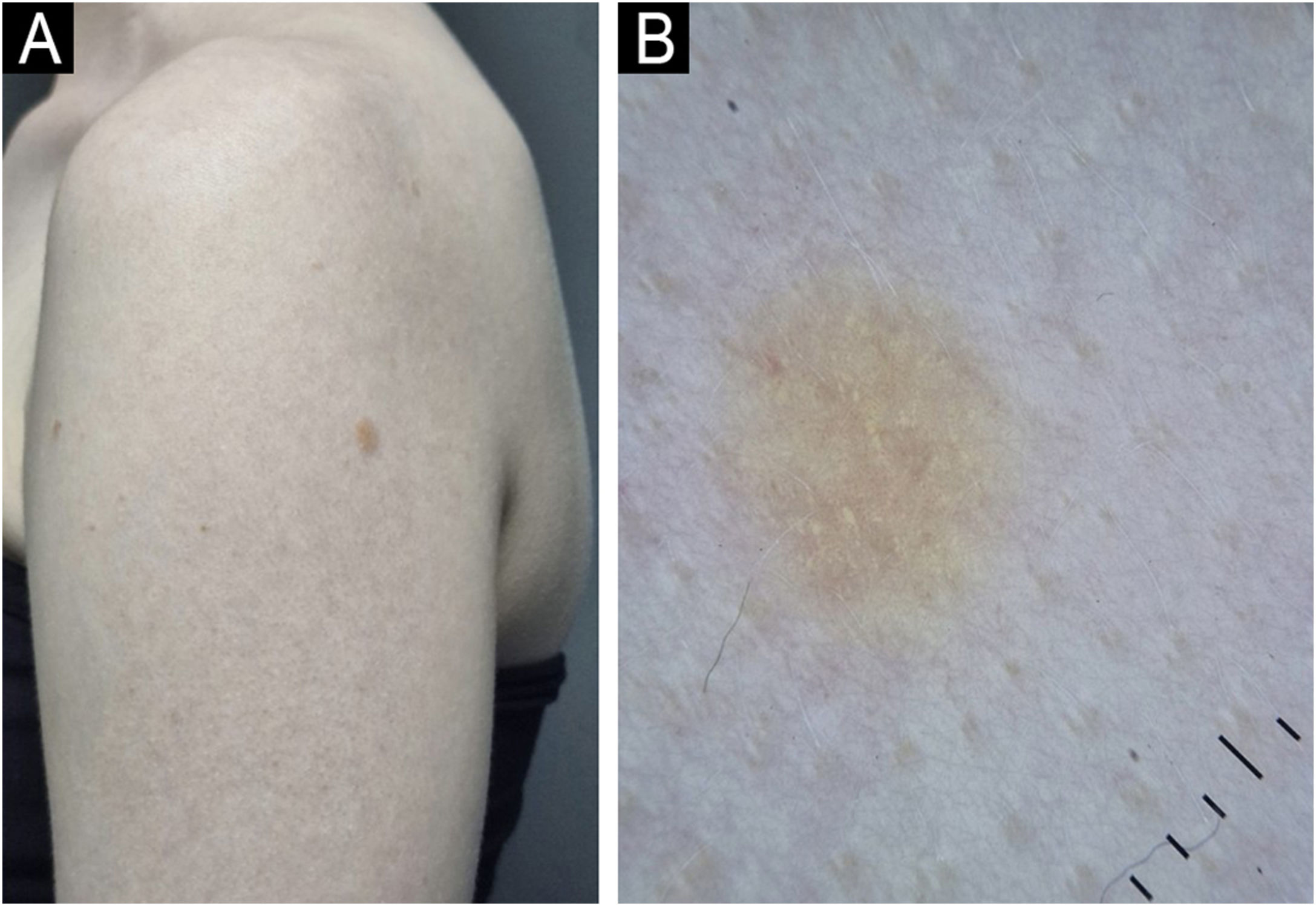 fig0005